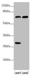 Polyclonal Rabbit anti-Human PPP2R3B Antibody (IHC, WB)
