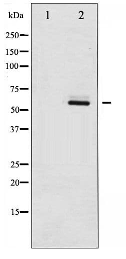 ESR2 / ER Beta Antibody (phospho-Ser105)