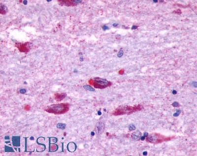 PathPlus™ OPN5 / Neuropsin Antibody (C-Terminus)