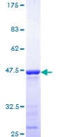 Human CUX1 / CASP Protein (Recombinant GST, N-terminus)
