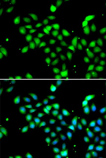METTL13 / KIAA0859 Antibody
