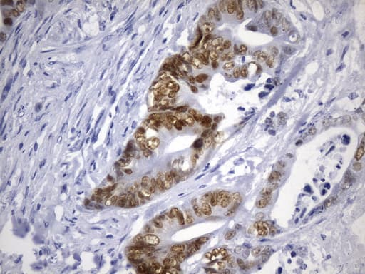 CDX2 Antibody (clone UMAB266, Carrier-free)