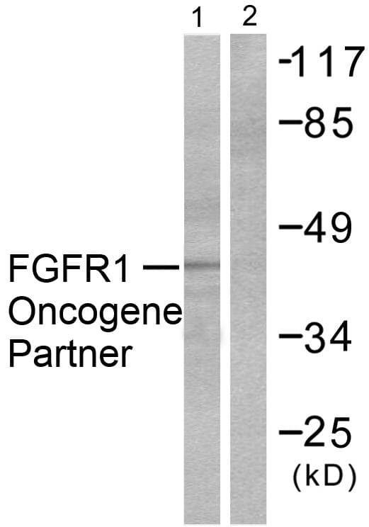Polyclonal Rabbit anti-Human FGFR1OP / FOP Antibody (IHC, WB)
