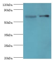 BIRC2 / cIAP1 Antibody (aa1-300)