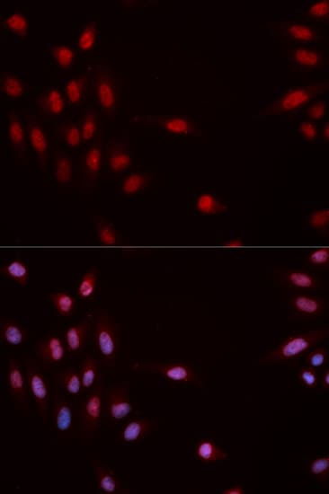 CHEK1 / CHK1 Antibody (phospho-Ser317)