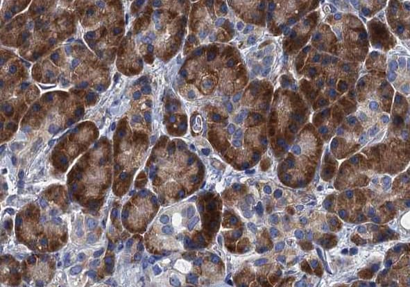 Polyclonal Rabbit anti-Human TNFSF12 / TWEAK Antibody (IHC, IF, WB)