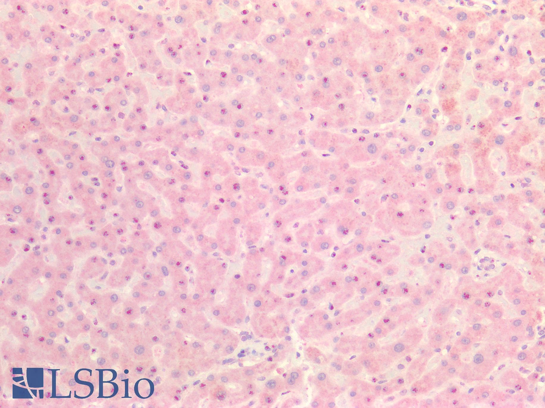 IHC-plus™ Polyclonal Rabbit anti-Human INSR / Insulin Receptor Antibody (Internal, IHC)