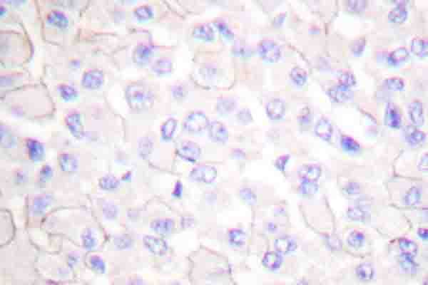 CDH1 / E Cadherin Antibody (Arg868)