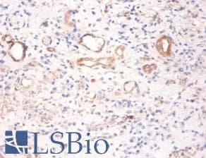 PKM / Pyruvate Kinase, Muscle Antibody (Biotin)
