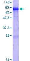 Human CAMK2D / CaMKII Delta Protein (Recombinant GST)