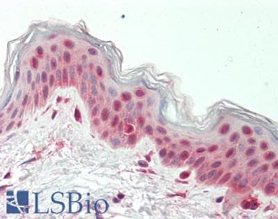 IHC-plus™ SNAI1 / SNAIL-1 Antibody (Internal)
