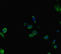 Polyclonal Rabbit anti-Human AIRE Antibody (IHC, IF)