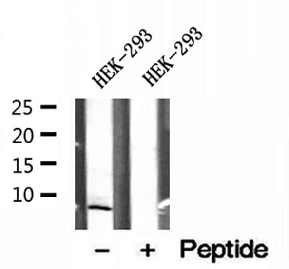 Polyclonal Rabbit anti-Human SEC61G Antibody (IHC, WB)
