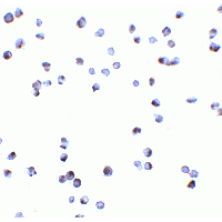 IHC-plus™ DAPK3 / ZIP Kinase Antibody