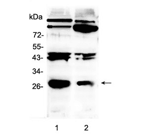 PDGF-BB Antibody