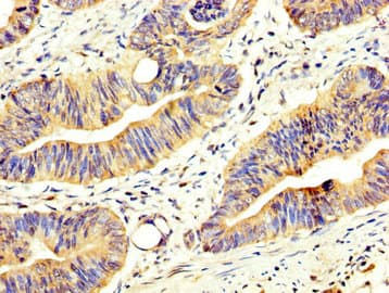 ABCD2 / ALDR Antibody