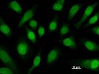 CBFB Antibody (clone 344C3a)