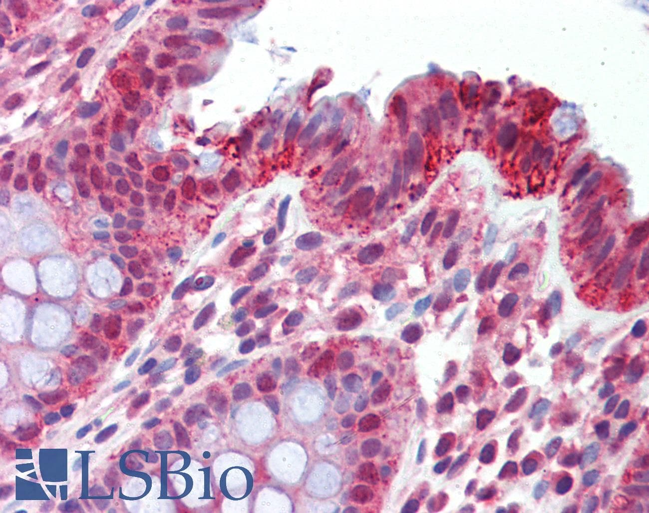 IHC-plus™ ITGA6/Integrin Alpha 6/CD49f Antibody (aa1043-1072)