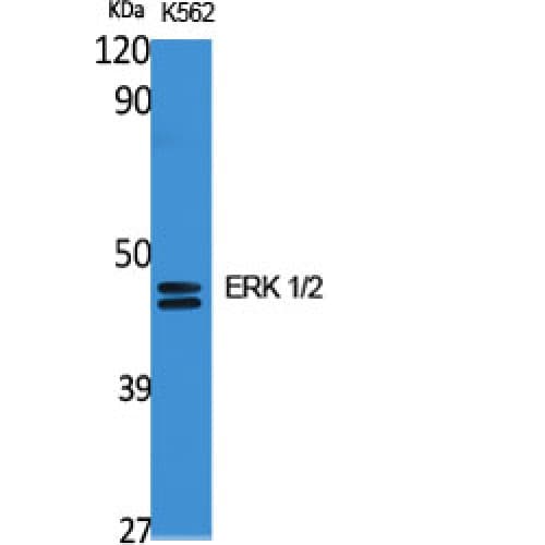 Polyclonal Rabbit anti-Human ERK1 + ERK2 Antibody (300-380 aa, C-terminal, IHC, WB)