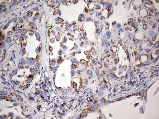 PIK3CD / PI3K Delta Antibody (aa286-610, clone OTI2H3)