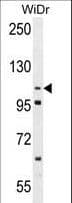 Polyclonal Rabbit anti-Human ADAM19 Antibody (aa207-236, IHC, WB)