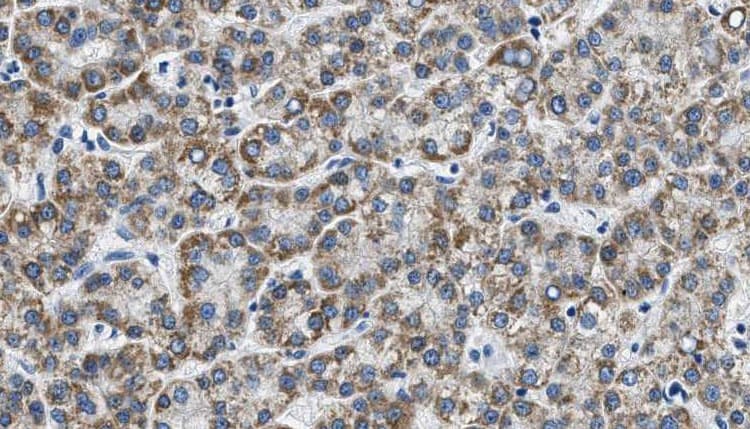 TJP1 / ZO-1 Antibody