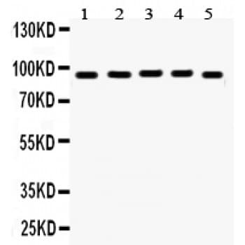 EWSR1 / EWS Antibody (aa369-399)