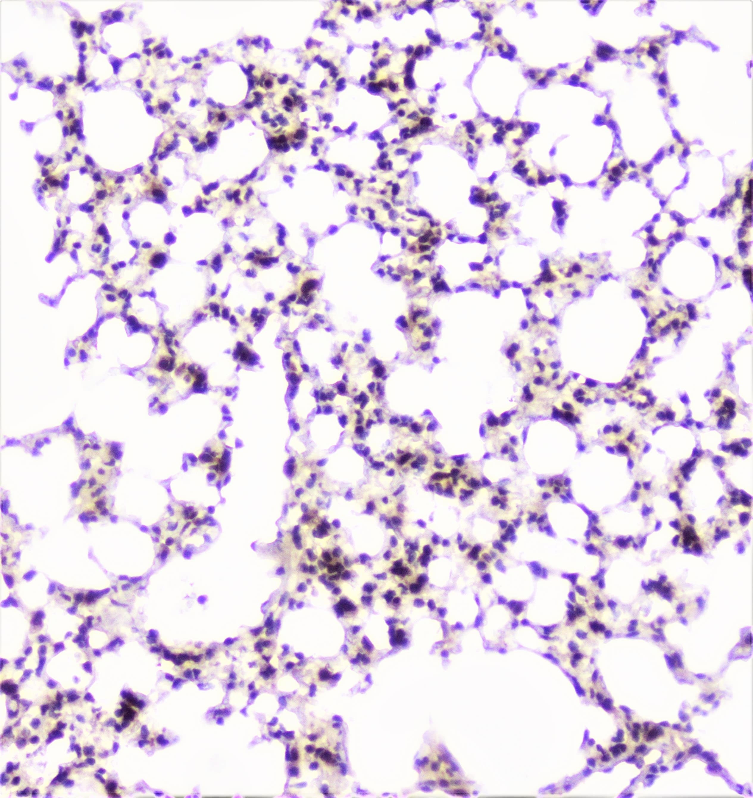 UBE2I / UBC9 Antibody