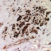 CHEK1 / CHK1 Antibody