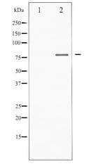 FOXO1 / FKHR Antibody