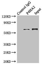 Polyclonal Rabbit anti-Human P4HA2 Antibody (aa236-535, IHC, WB)