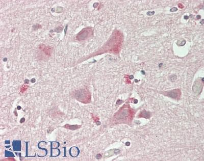 PathPlus™ RTN4R Antibody (Internal)