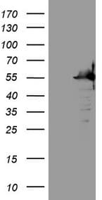 Monoclonal Mouse anti-Human SAMSN1 Antibody (clone OTI7F5, aa1-250, IHC, WB)