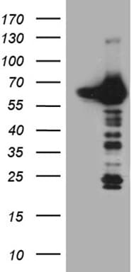 Monoclonal Mouse anti-Human CRY1 Antibody (clone OTI2F5, aa502-584, WB)