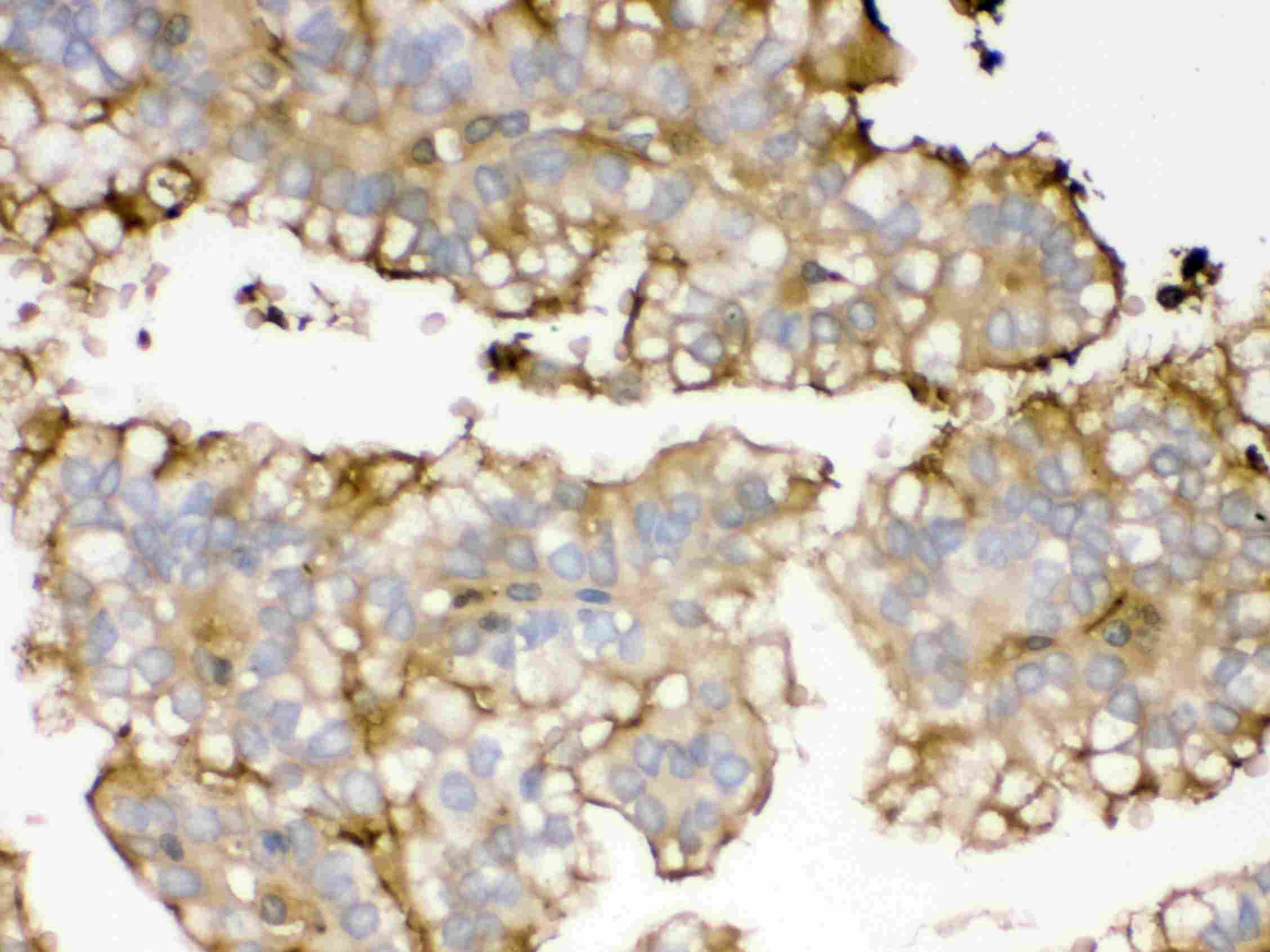 APOA1 / Apolipoprotein A 1 Antibody