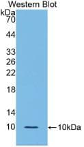 IL6R / IL6 Receptor Antibody (aa214-348)