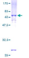 Human CSNK1A1L Protein (Recombinant GST)