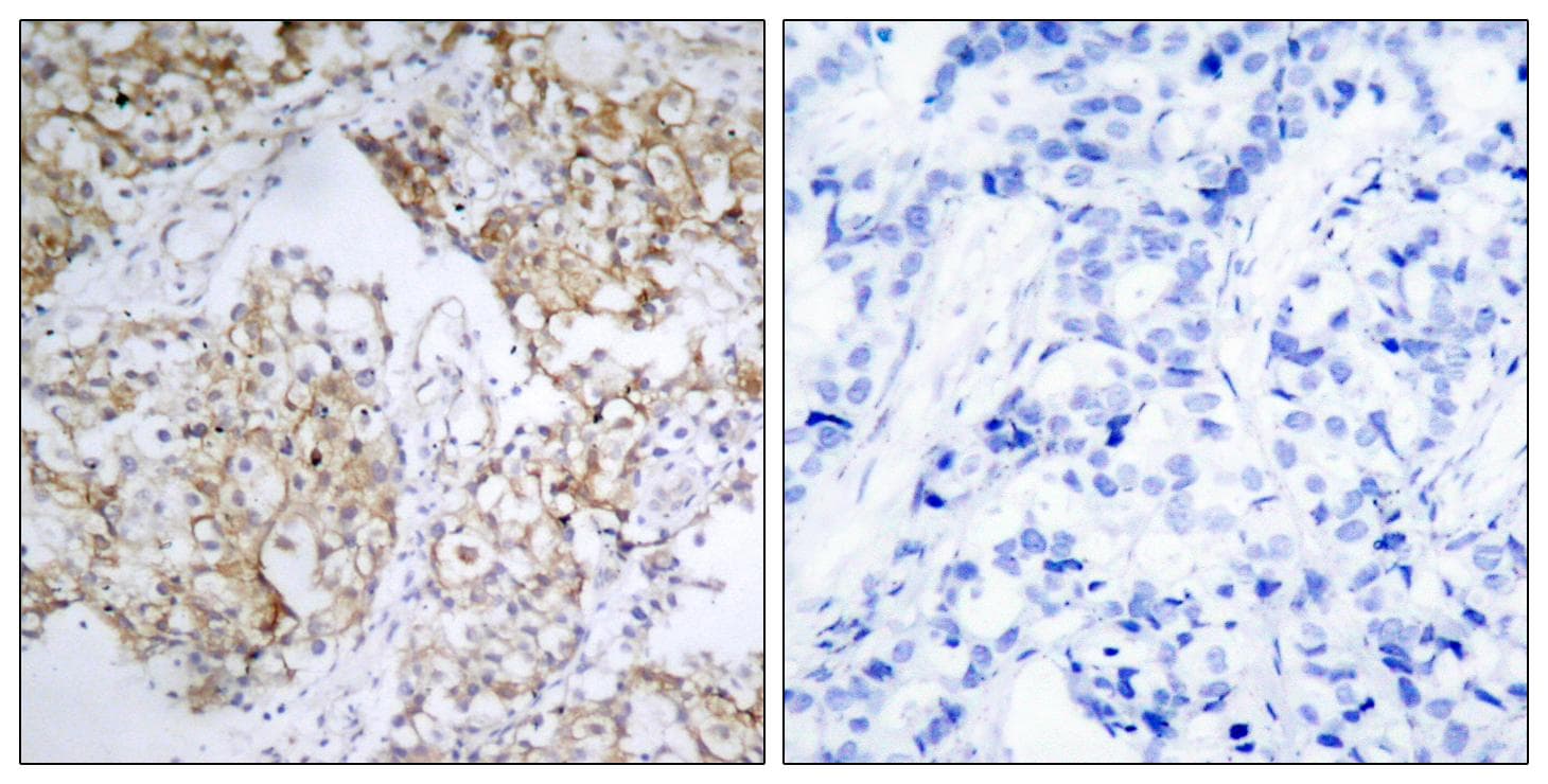 IGF1R / IGF1 Receptor Antibody (phospho-Tyr1161)