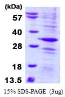 Human AMD / AMD1 Protein (Recombinant His)