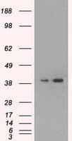Monoclonal Mouse anti-Human MAPK1 / ERK2 Antibody (clone OTI4C2, IHC, IF, WB)
