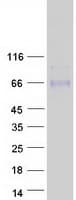Human ACCN5 / HINAC Protein (Recombinant Myc-DDK (Flag))