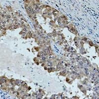 HSPA1L Antibody