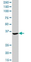ASGR2 Antibody (clone 1D7)