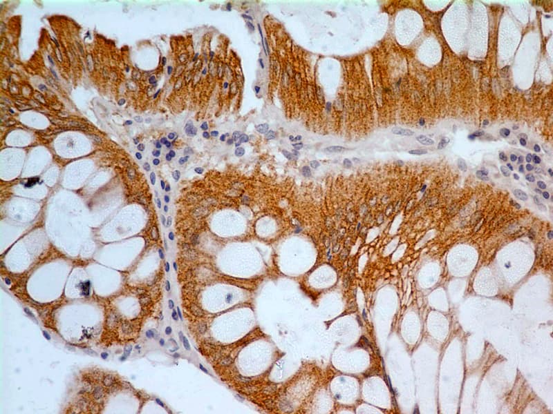 CASP3 / Caspase 3 Antibody