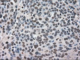 HSPA9 / Mortalin / GRP75 Antibody (clone OTI9F8)