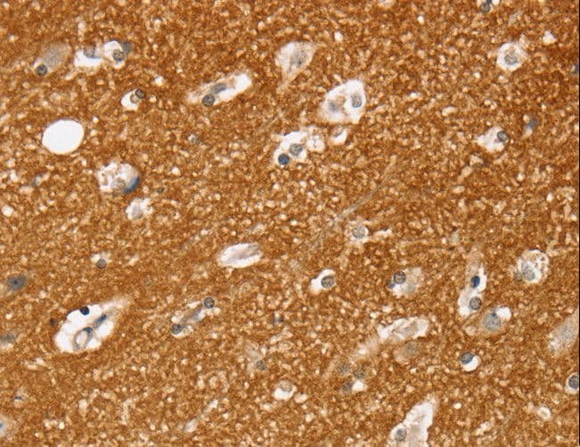 Polyclonal Rabbit anti-Human SLC25A13 / CITRIN Antibody (IHC, WB)