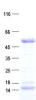 Human SOCS4 Protein (Recombinant His, N-Terminal)