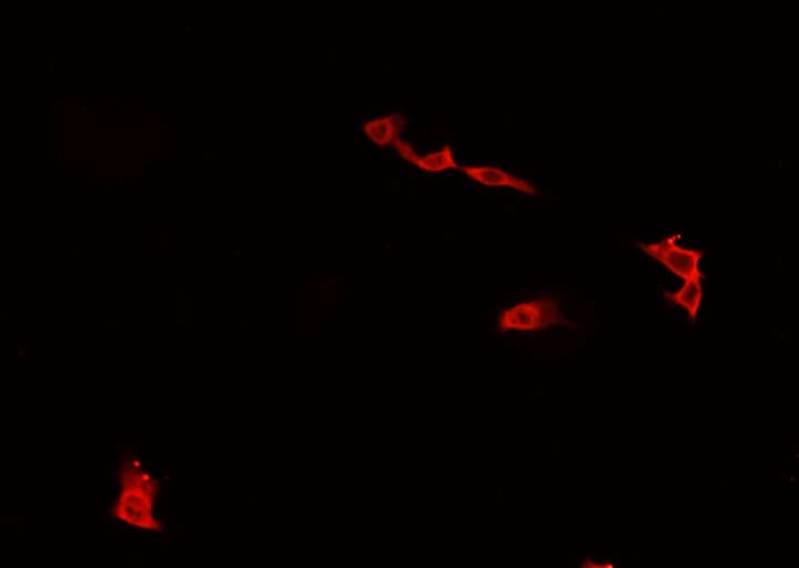 FOXO1 / FKHR Antibody