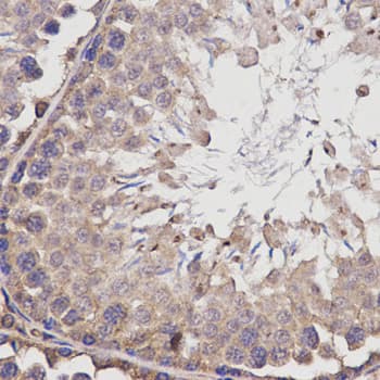 BCHE / Cholinesterase Antibody