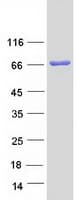 Human ACOX2 Protein (Recombinant Myc-DDK (Flag))